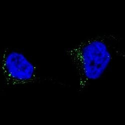 TYRP1 Antibody (CL4917), Novus Biologicals 25 &mu;L:Antibodies, Monoclonal